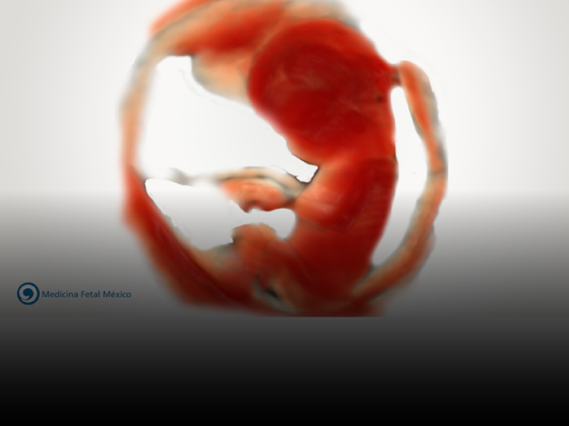 Curso Online Básico de Diagnóstico Prenatal en Primer Trimestre